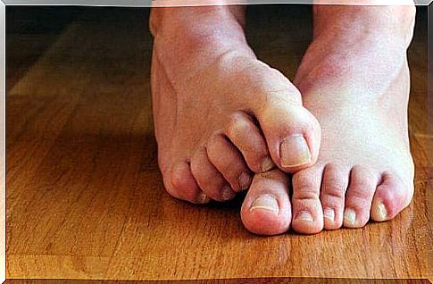 Fungal nails feet