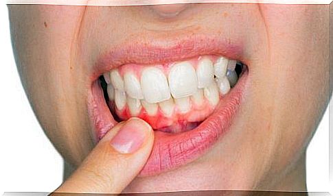 Dental abscesses and how to treat them