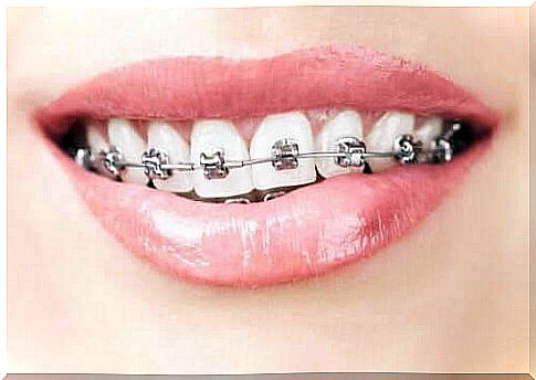 Orthodontics