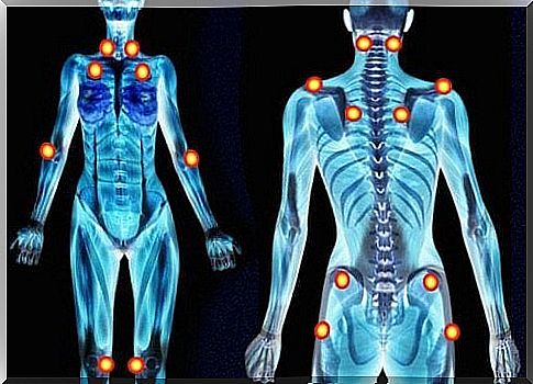 Five Early Signs of Fibromyalgia