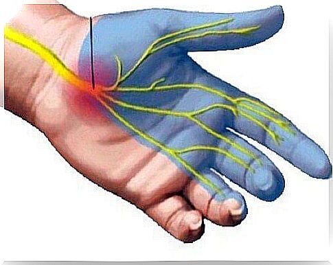 Causes of pain in carpal tunnel syndrome