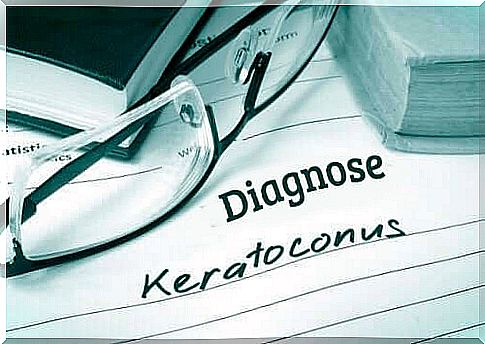 Keratoconus - features and treatment