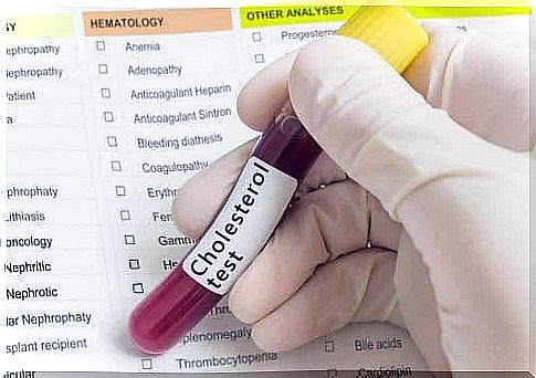 Tube with blood for a cholesterol test