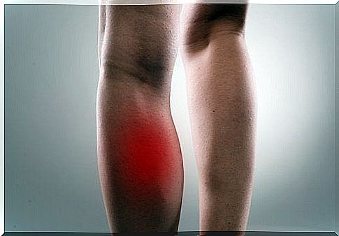 Natural remedies for muscle cramps