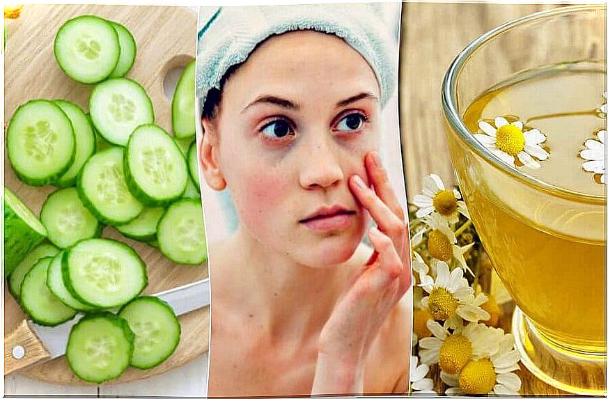 Reduce puffiness and dark circles with 5 natural ingredients