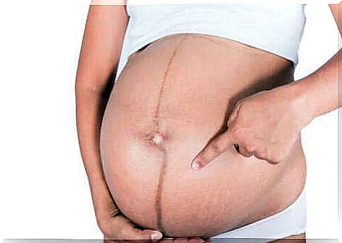 Skin changes during pregnancy