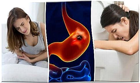 Woman with stomach ulcer symptoms