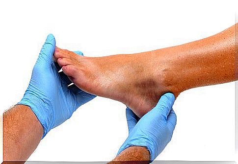 Swollen Ankles and Feet: Causes and Prevention