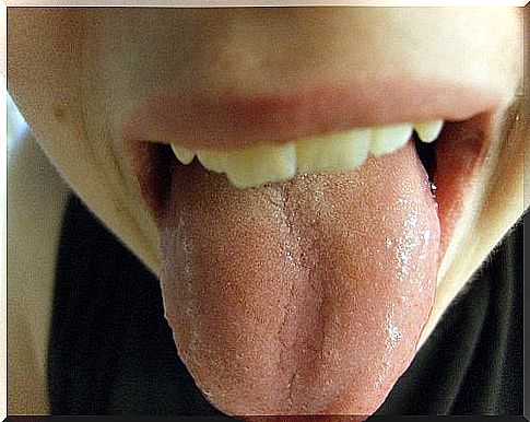 Blisters and red dots on the tongue